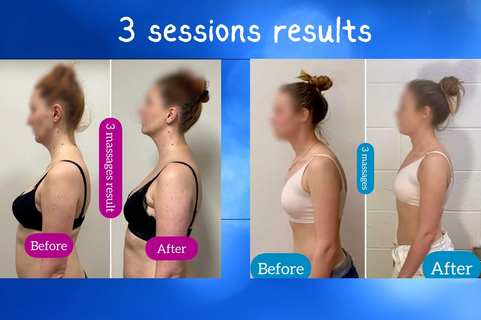 Two before-and-after examples following three postural massage sessions